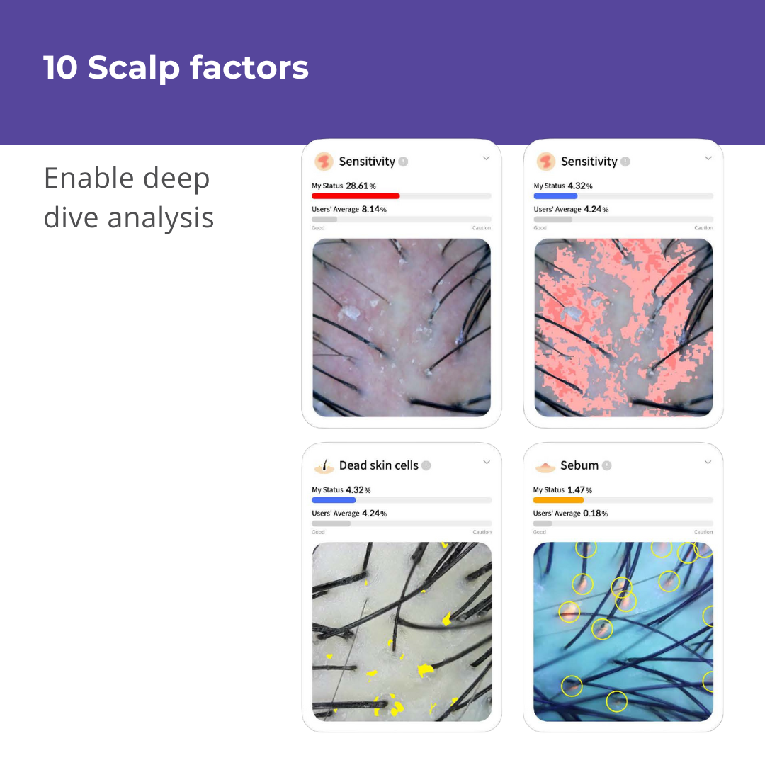 Becon AI analysis for Skin and Scalp Scanner (Device only)