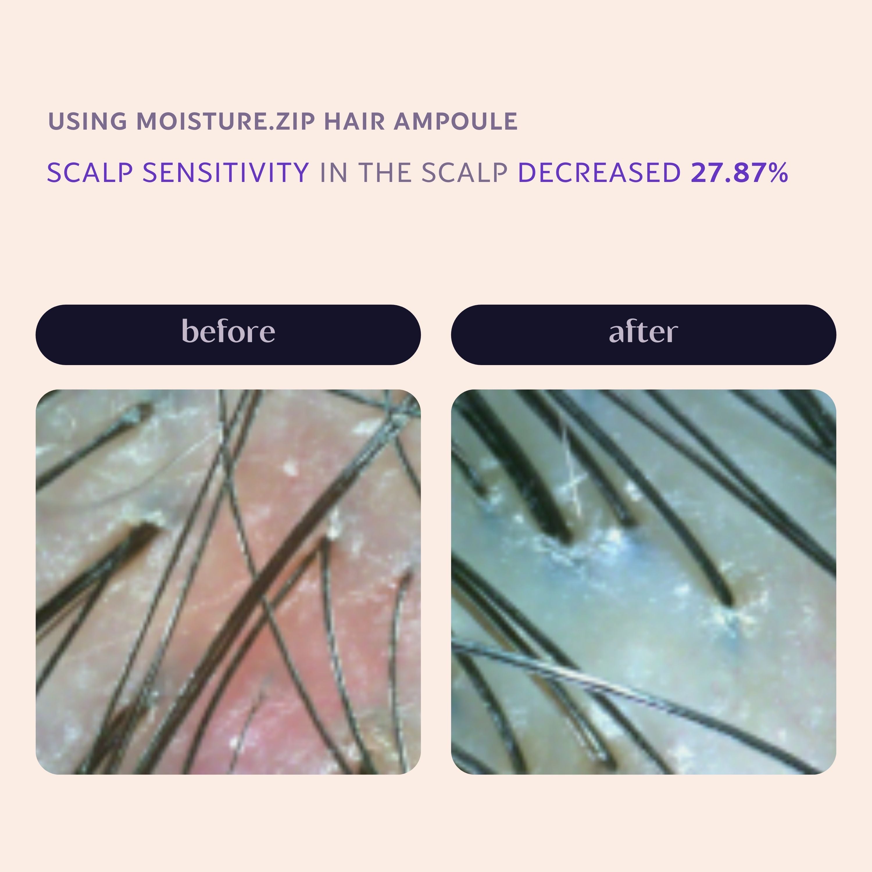 Moisture.zip Hair Serum Ampoule