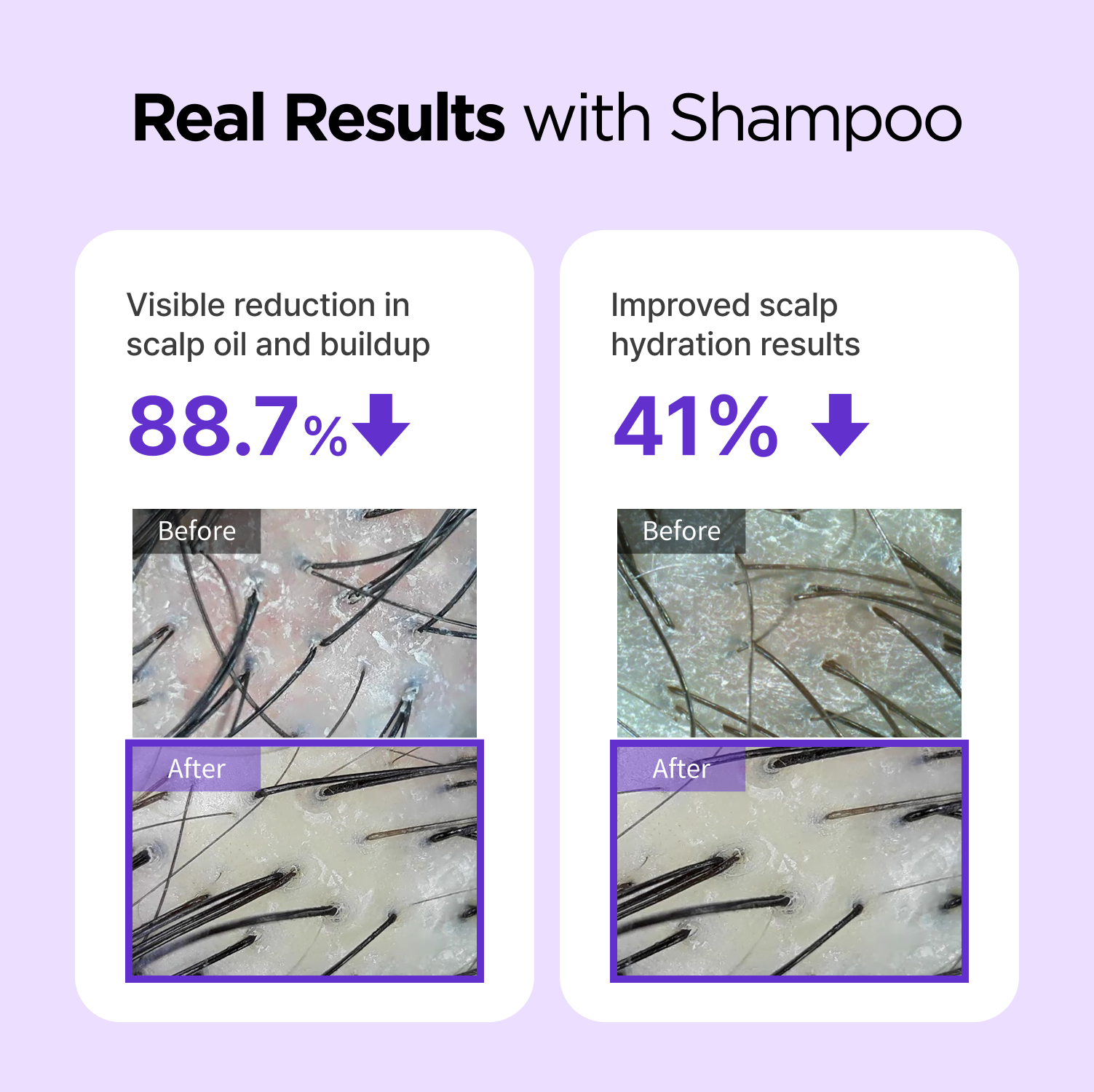 BeConfident Shampoo 12.17 fl oz
