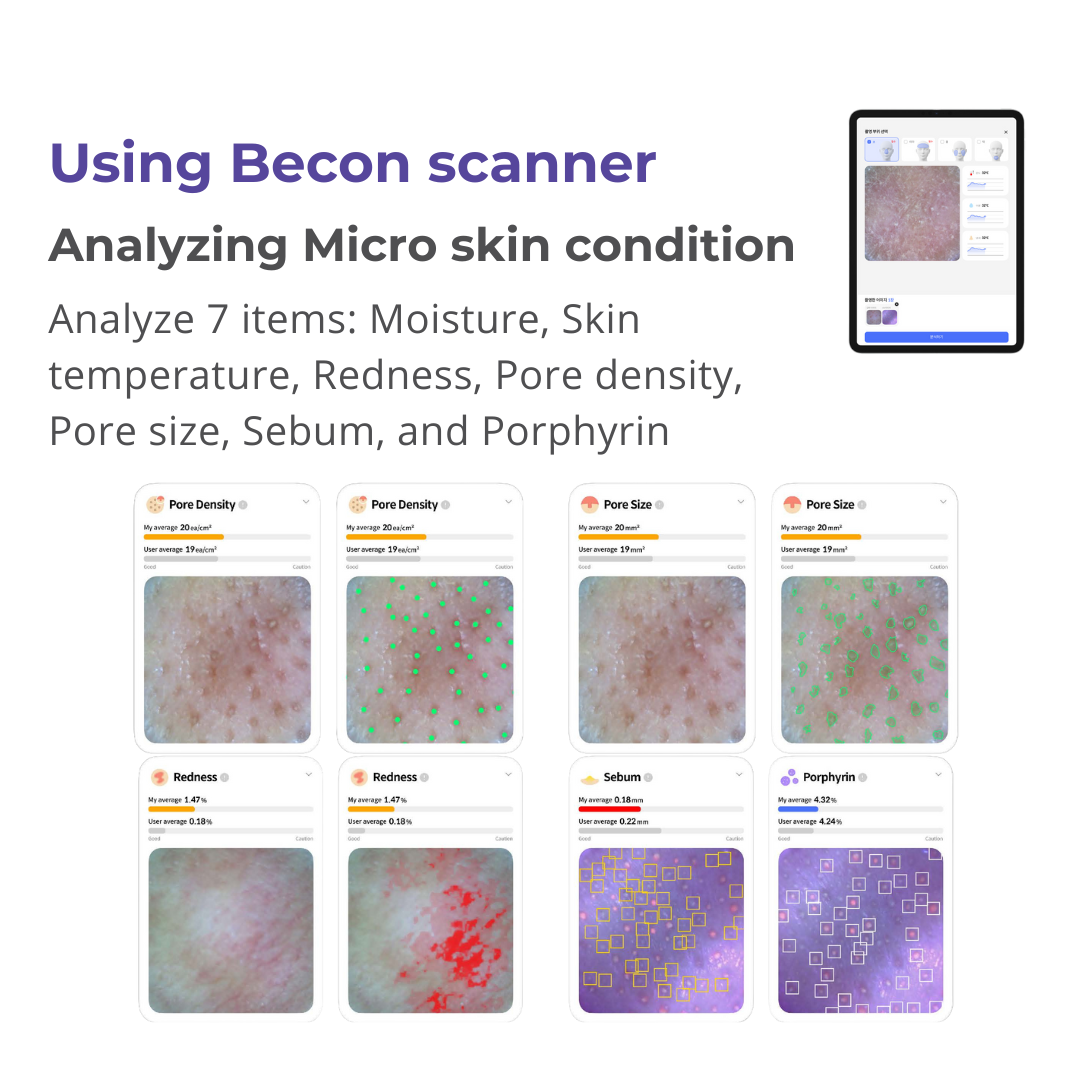 WithBecon Revolutionary Hair and Skin IoT AI Scanner – Withbecon