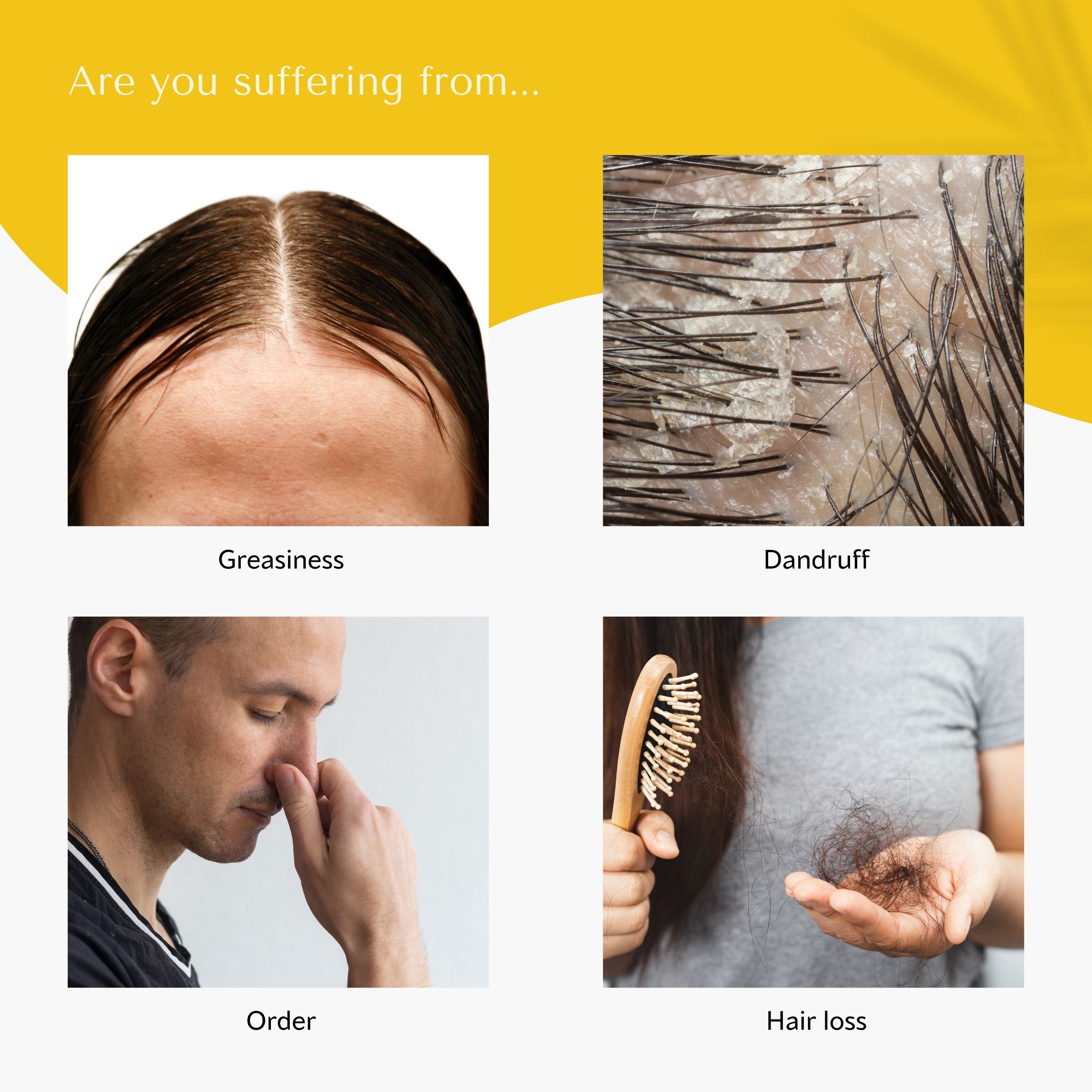 WithBecon no more oil Shampoo, best shampoo for hair loss, best shampoo for hair loss female, anti hair loss shampoo, dermatologist recommended shampoo for hair loss, hair loss shampoo for men, good shampoo for hair loss, best shampoo for hair loss men, best shampoo and conditioner for hair loss, shampoo to prevent hair loss, shampoo to help with hair loss, mild shampoo for hair loss, organic shampoo for hair loss