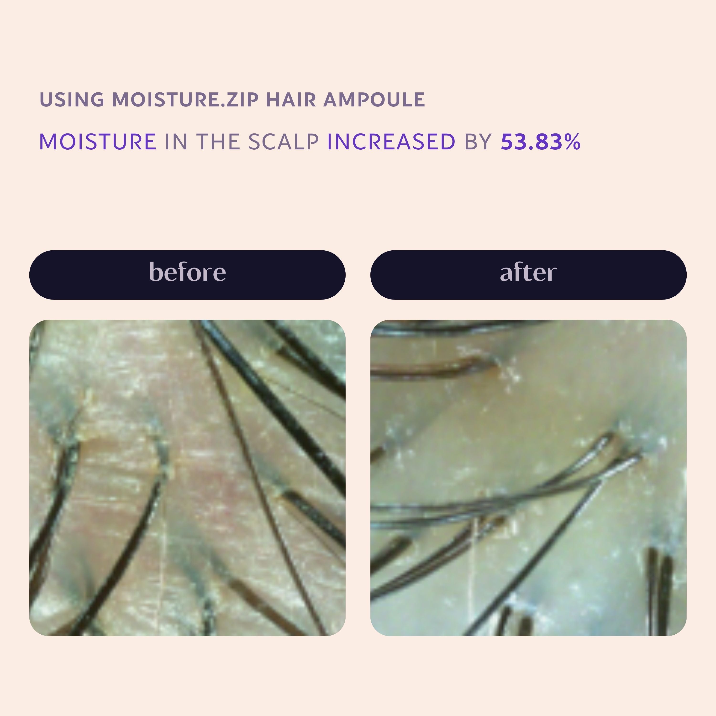 Moisture.zip Hair Serum Ampoule