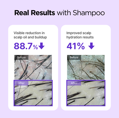 BeConfident Shampoo 12.17 fl oz