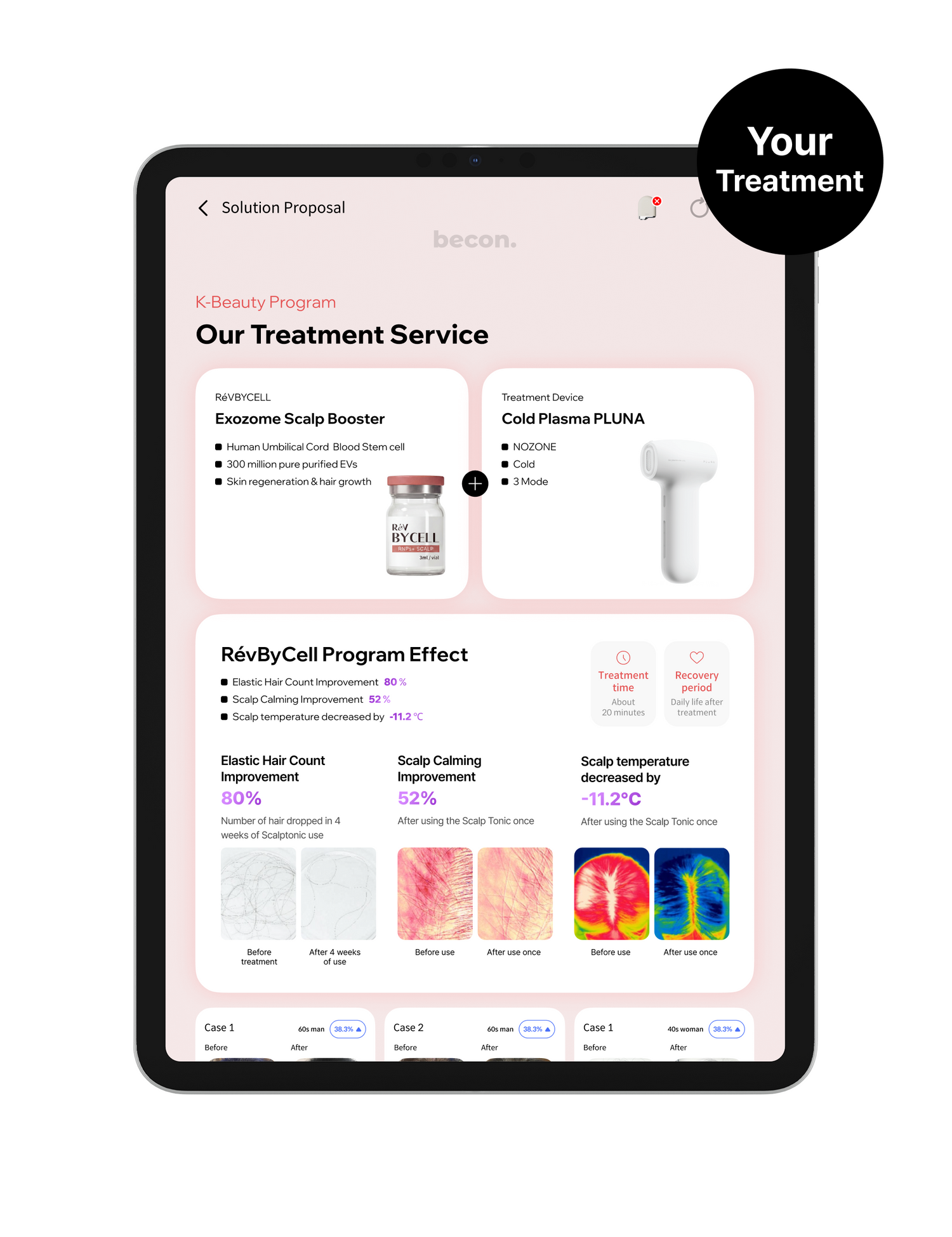 Treatment Integration