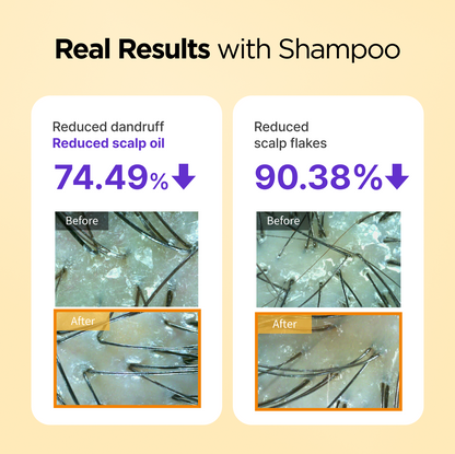 NoMoreOil Shampoo 12.17 fl oz